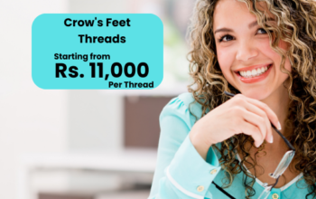 Crow’s Feet Threads Cost Islamabad Lahore Karachi